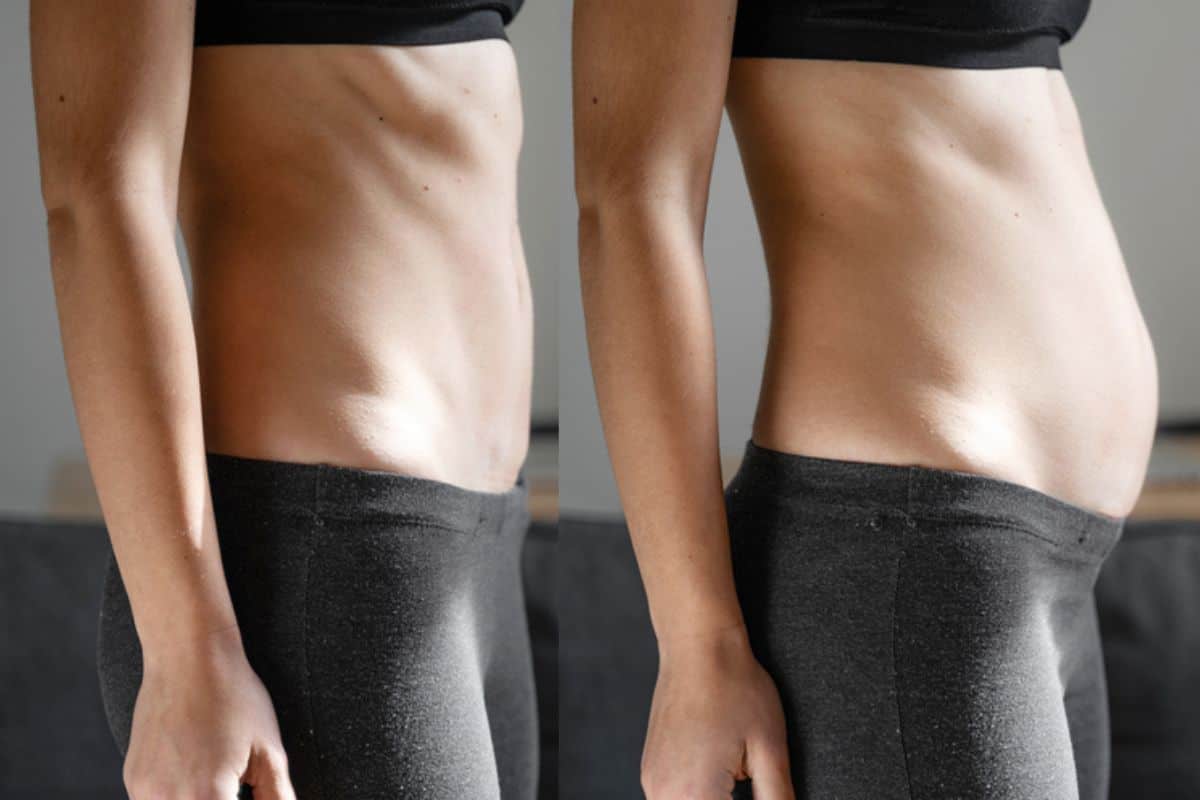 How long does diastasis recti take to improve Newmarket?