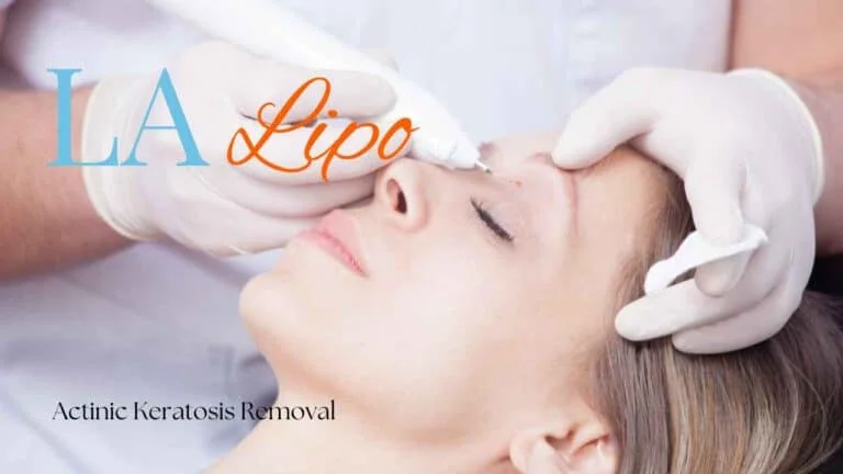Woman receiving Actinic Keratosis Removal Treatment Newmarket
