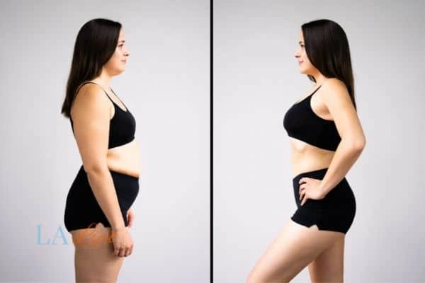 LA-EMS Body Sculpting Newmarket results before and after of womans results on body toning.