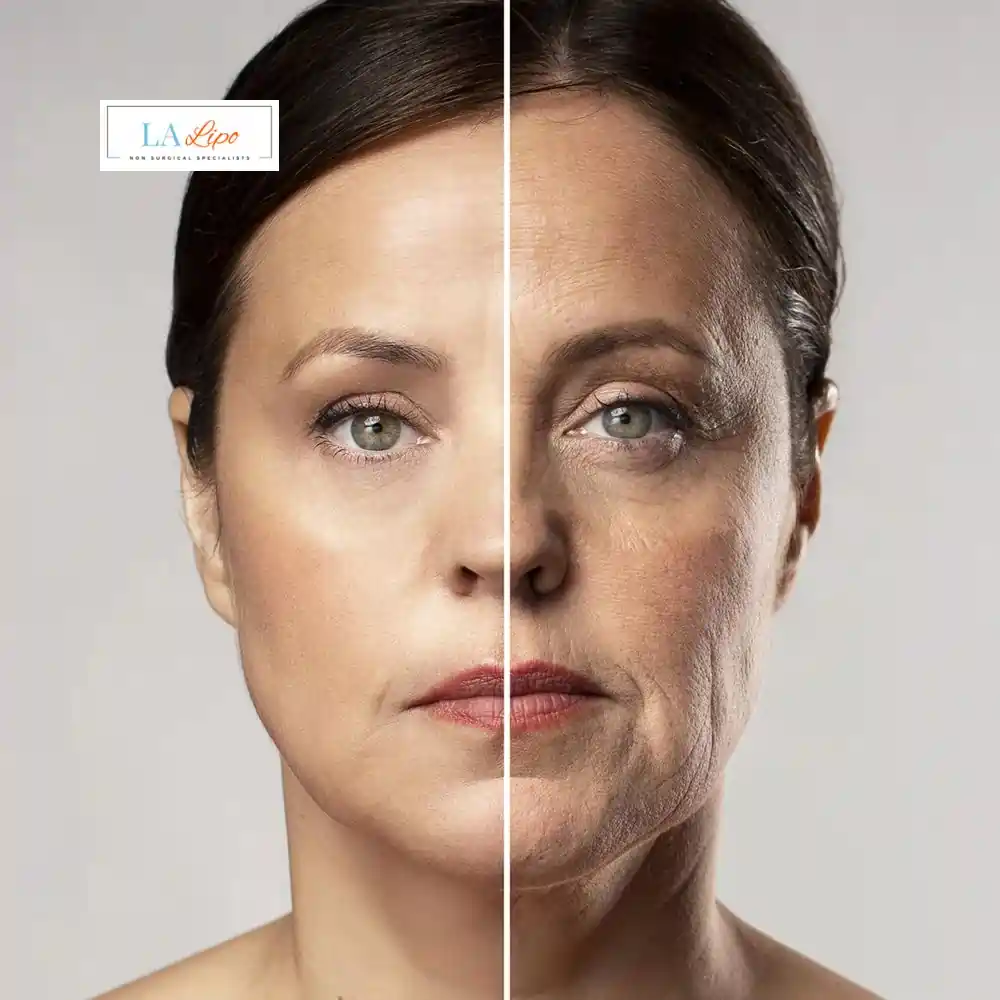 How Can You Tell If Non-Surgical Skin Tightening Is Right for You Newmarket?