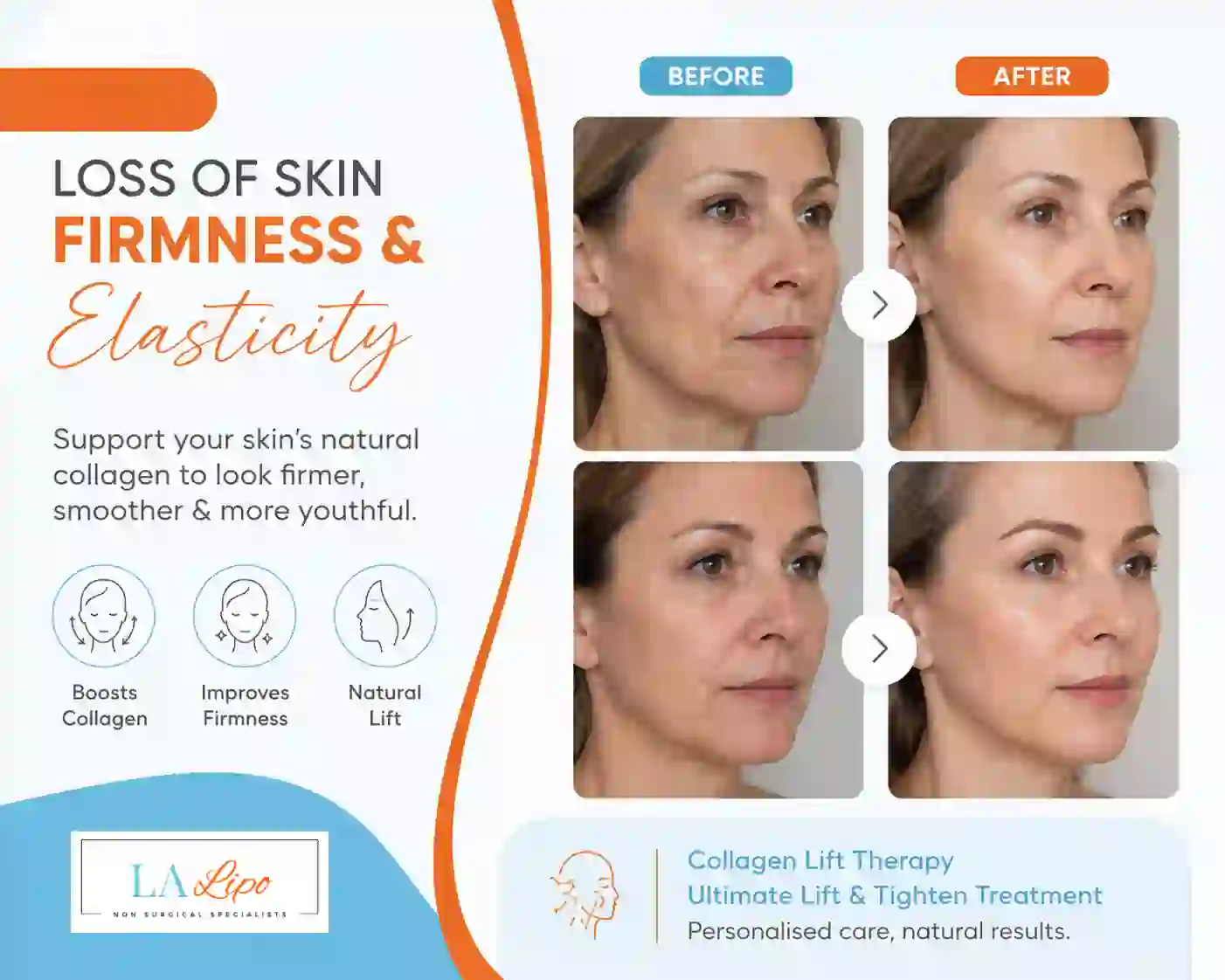 Sign #7: Loss of Skin Firmness and Elasticity Newmarket
