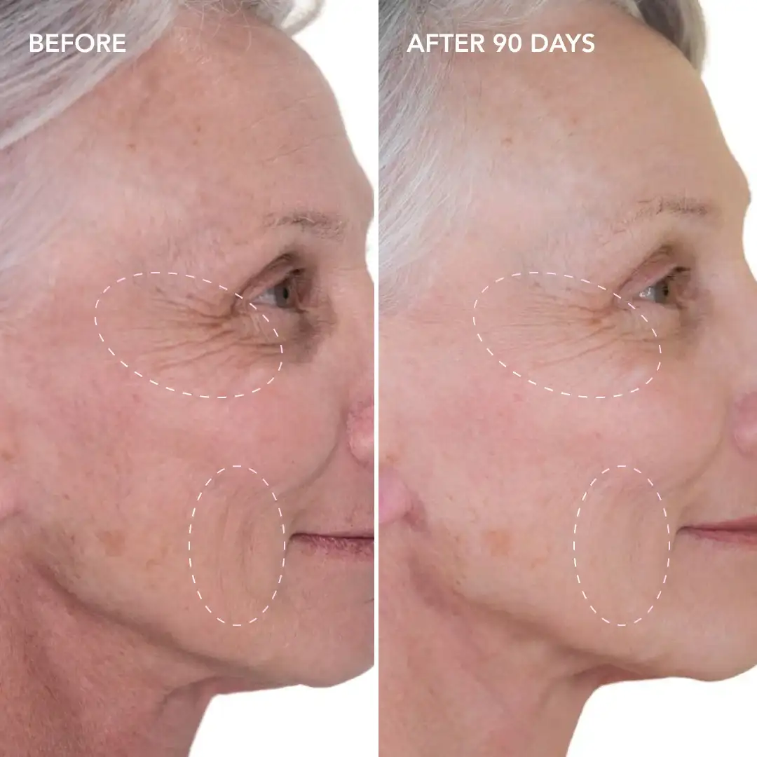 When will you see results Newmarket